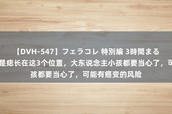 【DVH-547】フェラコレ 特別編 3時間まるごとWフェラ 若是痣长在这3个位置，大东说念主小孩都要当心了，可能有癌变的风险